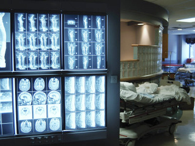 Images of X-Rays on Medical Computer Screen