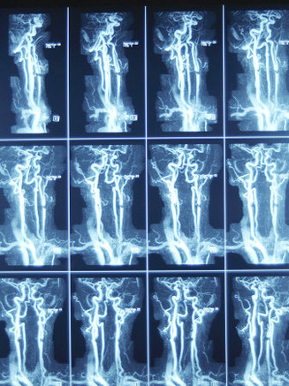 Images of X-Rays on Medical Computer Screen