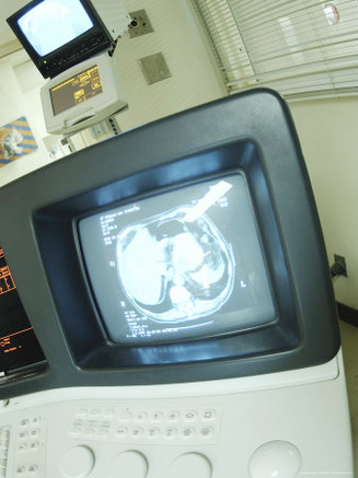 Image of Cat Scan on Medical Computer Screen