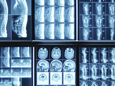 X-Ray Images on Computer Screen