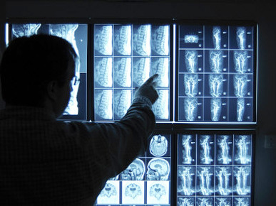 Doctor Pointing to X-Ray Images on Computer Screen